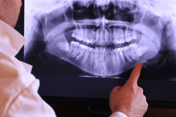 Best Emergency Dental Care for Broken or Chipped Teeth in Highland, AR